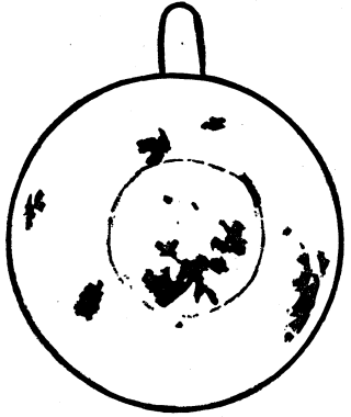 Figure XI